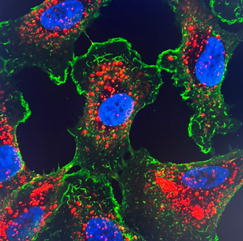 Microscopia confocal